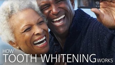 a couple smiling and laughing with how tooth whitening works in writing