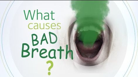 a picture of someone's mouth with green smoke and the caption - What causes bad breath
